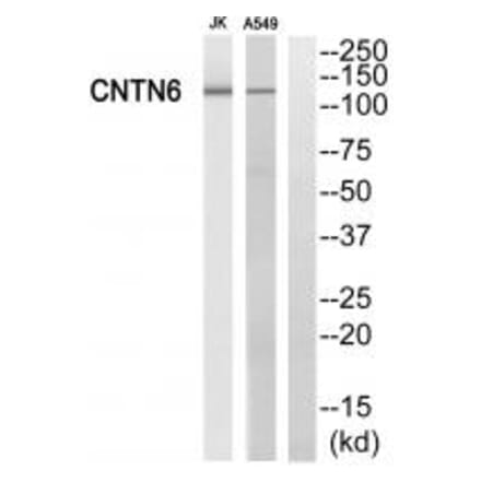 Western blot - CNTN6 Antibody from Signalway Antibody (34620) - Antibodies.com