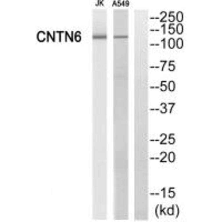 Western blot - CNTN6 Antibody from Signalway Antibody (34620) - Antibodies.com