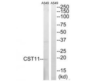 Western blot - CST11 Antibody from Signalway Antibody (34626) - Antibodies.com