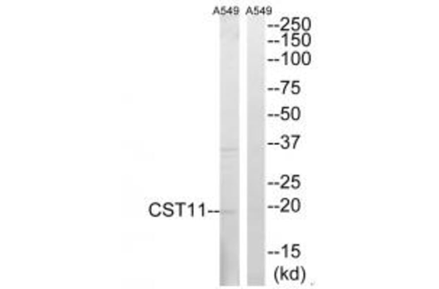 Western blot - CST11 Antibody from Signalway Antibody (34626) - Antibodies.com