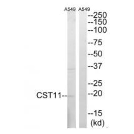 Western blot - CST11 Antibody from Signalway Antibody (34626) - Antibodies.com