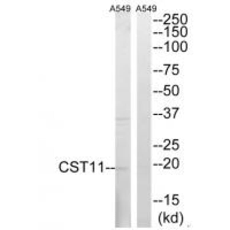 Western blot - CST11 Antibody from Signalway Antibody (34626) - Antibodies.com