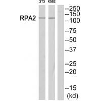 Western blot analysis of extracts from Jurkat/NIH-3T3 cells, using POLR1B antibody #34651.