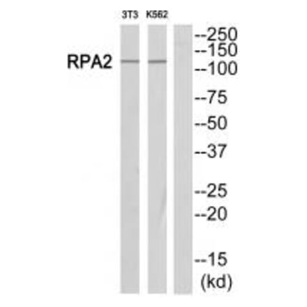 Western blot - POLR1B Antibody from Signalway Antibody (34651) - Antibodies.com