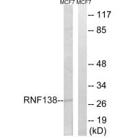 Western blot analysis of extracts from MCF-7 cells, using RNF138 antibody #34663.