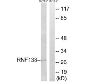 Western blot - RNF138 Antibody from Signalway Antibody (34663) - Antibodies.com