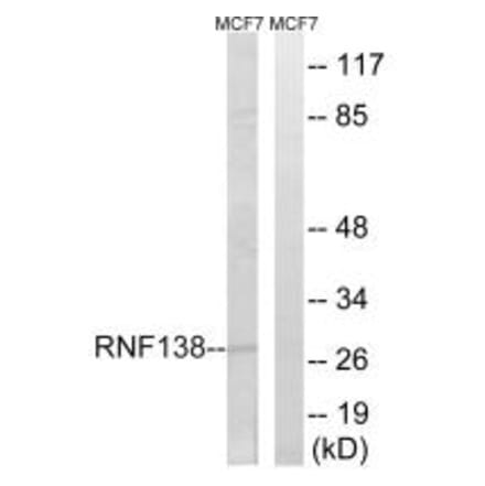 Western blot - RNF138 Antibody from Signalway Antibody (34663) - Antibodies.com