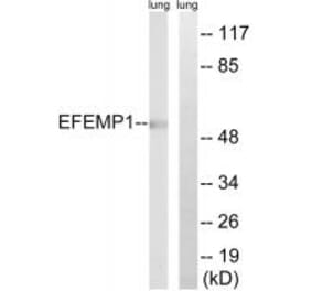 Western blot - EFEMP1 Antibody from Signalway Antibody (34665) - Antibodies.com