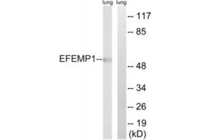 Western blot - EFEMP1 Antibody from Signalway Antibody (34665) - Antibodies.com