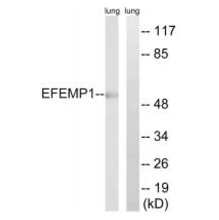 Western blot - EFEMP1 Antibody from Signalway Antibody (34665) - Antibodies.com