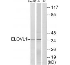 Western blot - ELOVL1 Antibody from Signalway Antibody (34670) - Antibodies.com
