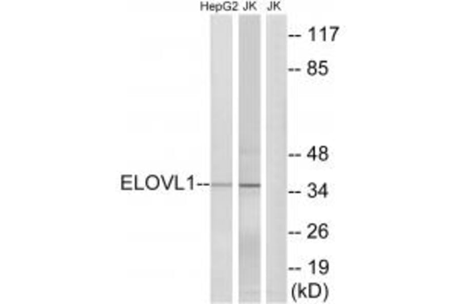 Western blot - ELOVL1 Antibody from Signalway Antibody (34670) - Antibodies.com