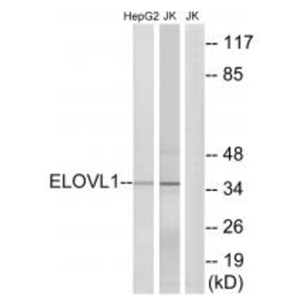 Western blot - ELOVL1 Antibody from Signalway Antibody (34670) - Antibodies.com