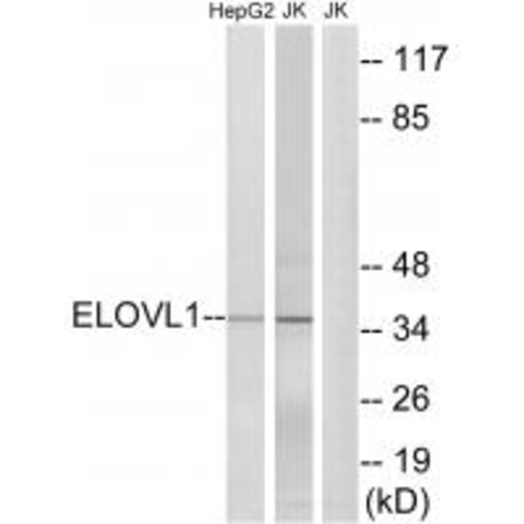 Western blot - ELOVL1 Antibody from Signalway Antibody (34670) - Antibodies.com