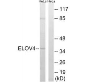 Western blot - ELOVL4 Antibody from Signalway Antibody (34672) - Antibodies.com