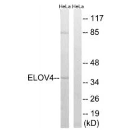 Western blot - ELOVL4 Antibody from Signalway Antibody (34672) - Antibodies.com