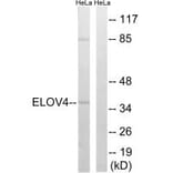 Western blot - ELOVL4 Antibody from Signalway Antibody (34672) - Antibodies.com