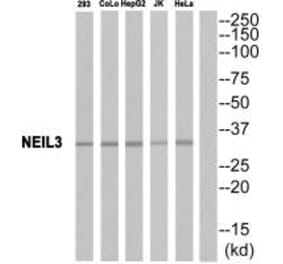 Western blot - EPHA10 Antibody from Signalway Antibody (34674) - Antibodies.com