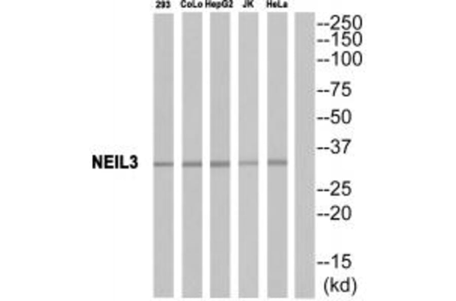 Western blot - EPHA10 Antibody from Signalway Antibody (34674) - Antibodies.com