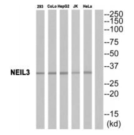 Western blot - EPHA10 Antibody from Signalway Antibody (34674) - Antibodies.com
