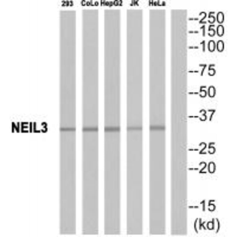 Western blot - EPHA10 Antibody from Signalway Antibody (34674) - Antibodies.com