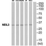 Western blot - EPHA10 Antibody from Signalway Antibody (34674) - Antibodies.com