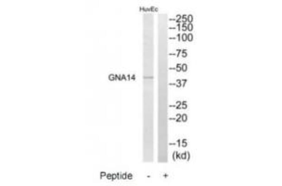 Western blot - GNA14 Antibody from Signalway Antibody (34725) - Antibodies.com