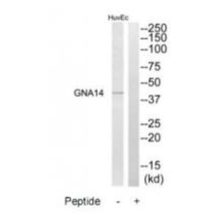 Western blot - GNA14 Antibody from Signalway Antibody (34725) - Antibodies.com