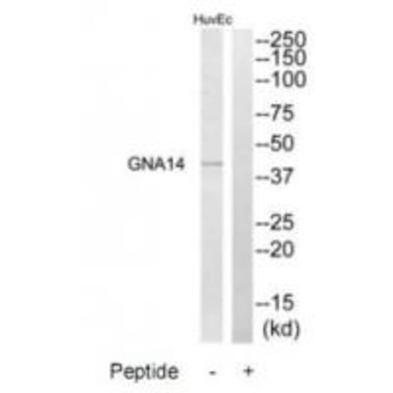 Western blot - GNA14 Antibody from Signalway Antibody (34725) - Antibodies.com