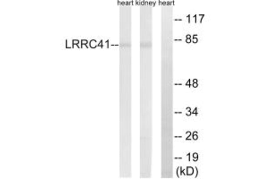 Western blot - LRRC41 Antibody from Signalway Antibody (34756) - Antibodies.com
