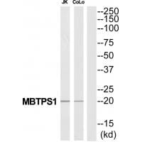 Western blot analysis of extracts from Jurkat/COLO205 cells, using MBTPS1 antibody #34783.