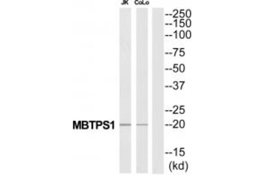 Western blot - MBTPS1 Antibody from Signalway Antibody (34783) - Antibodies.com