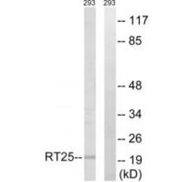 Western blot - MRPS25 Antibody from Signalway Antibody (34792) - Antibodies.com
