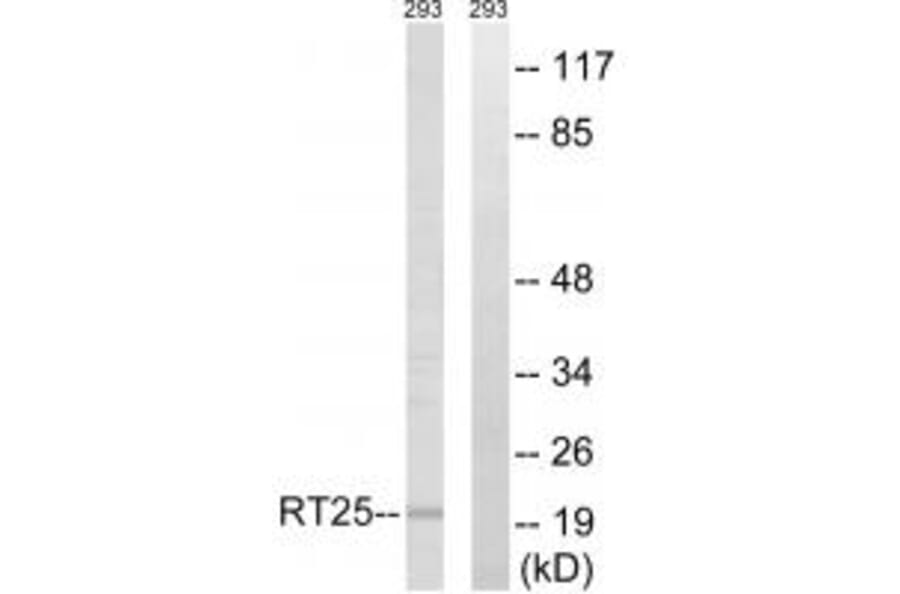 Western blot - MRPS25 Antibody from Signalway Antibody (34792) - Antibodies.com