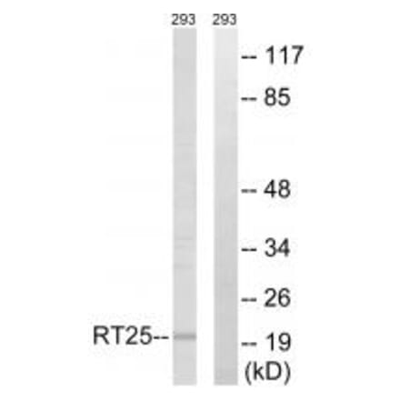 Western blot - MRPS25 Antibody from Signalway Antibody (34792) - Antibodies.com