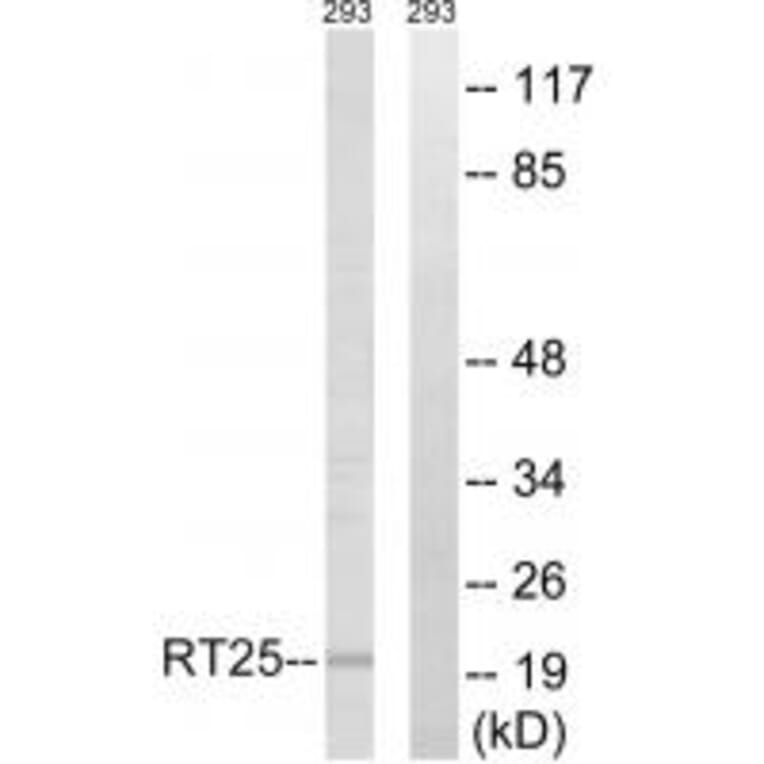 Western blot - MRPS25 Antibody from Signalway Antibody (34792) - Antibodies.com