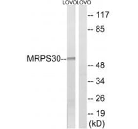 Western blot - MRPS30 Antibody from Signalway Antibody (34794) - Antibodies.com