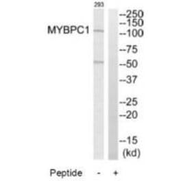 Western blot - MYBPC1 Antibody from Signalway Antibody (34821) - Antibodies.com