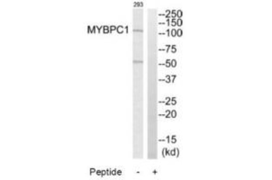 Western blot - MYBPC1 Antibody from Signalway Antibody (34821) - Antibodies.com