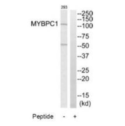 Western blot - MYBPC1 Antibody from Signalway Antibody (34821) - Antibodies.com