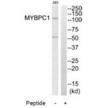 Western blot - MYBPC1 Antibody from Signalway Antibody (34821) - Antibodies.com