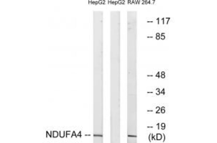 Western blot - NDUFA4 Antibody from Signalway Antibody (34827) - Antibodies.com