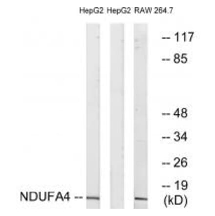 Western blot - NDUFA4 Antibody from Signalway Antibody (34827) - Antibodies.com