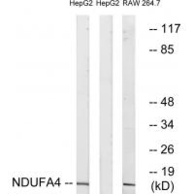 Western blot - NDUFA4 Antibody from Signalway Antibody (34827) - Antibodies.com