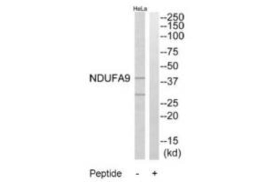 Western blot - NDUFA9 Antibody from Signalway Antibody (34830) - Antibodies.com