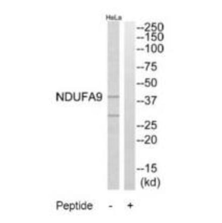 Western blot - NDUFA9 Antibody from Signalway Antibody (34830) - Antibodies.com