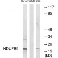 Western blot analysis of extracts from COLO cells and 293 cells, using NDUFB9 antibody #34832.