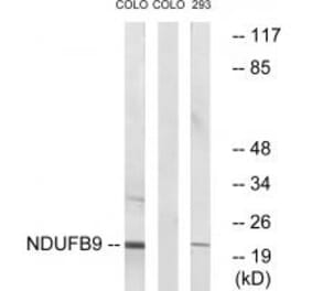 Western blot - NDUFB9 Antibody from Signalway Antibody (34832) - Antibodies.com
