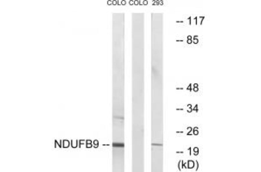 Western blot - NDUFB9 Antibody from Signalway Antibody (34832) - Antibodies.com