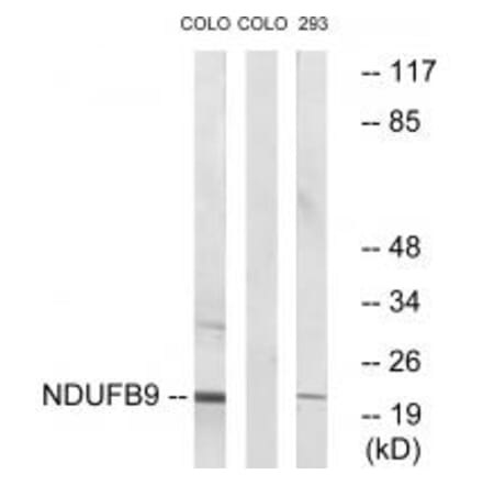 Western blot - NDUFB9 Antibody from Signalway Antibody (34832) - Antibodies.com